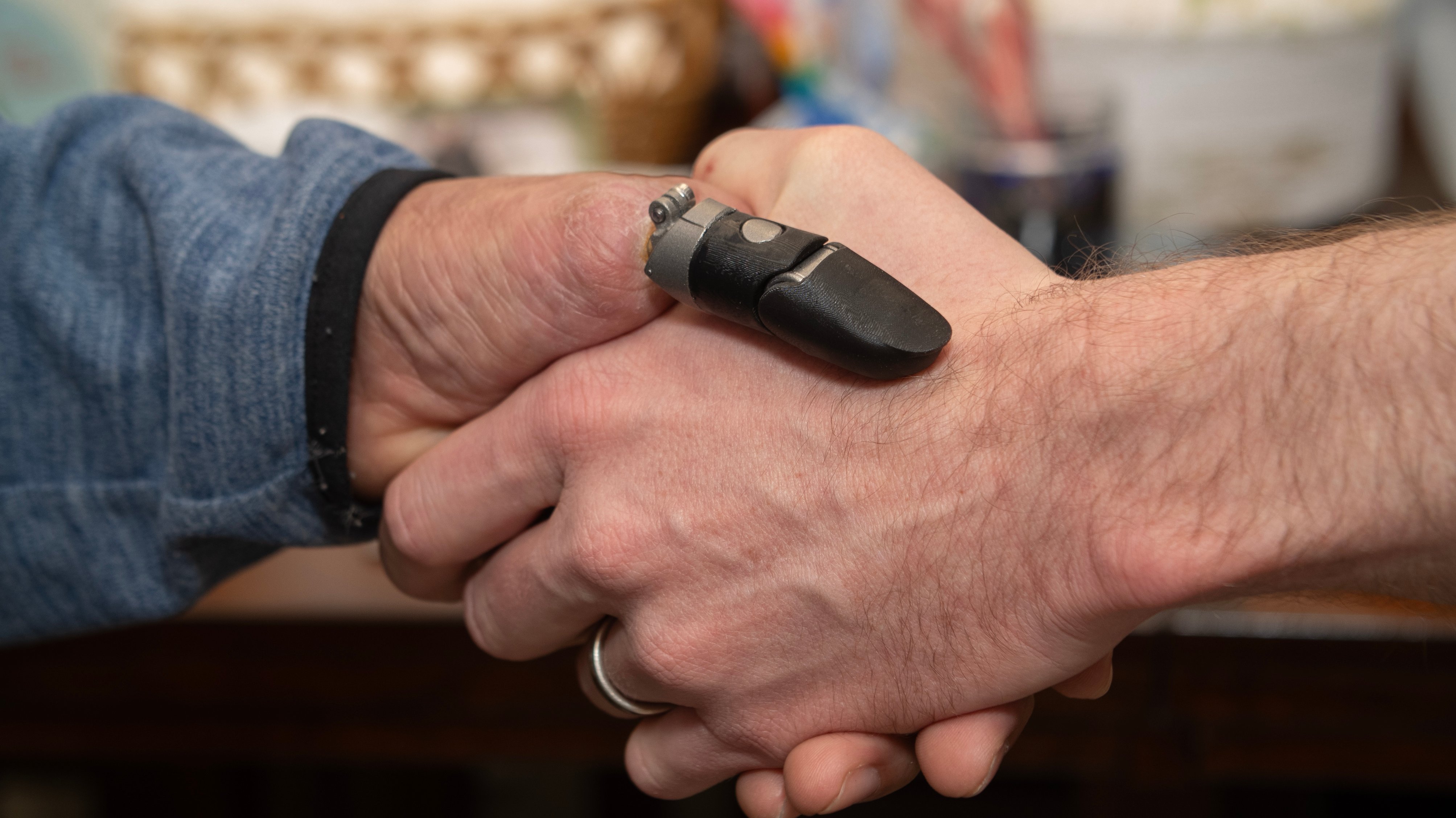 Osseointegrated prosthetic thumb opening up cinnamon container