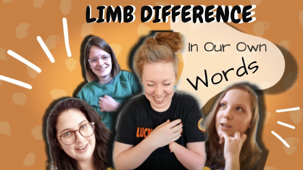 Embrace Your Limb Difference